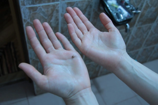 Bàn tay diệt muỗi: Chiến thắng chủ động.