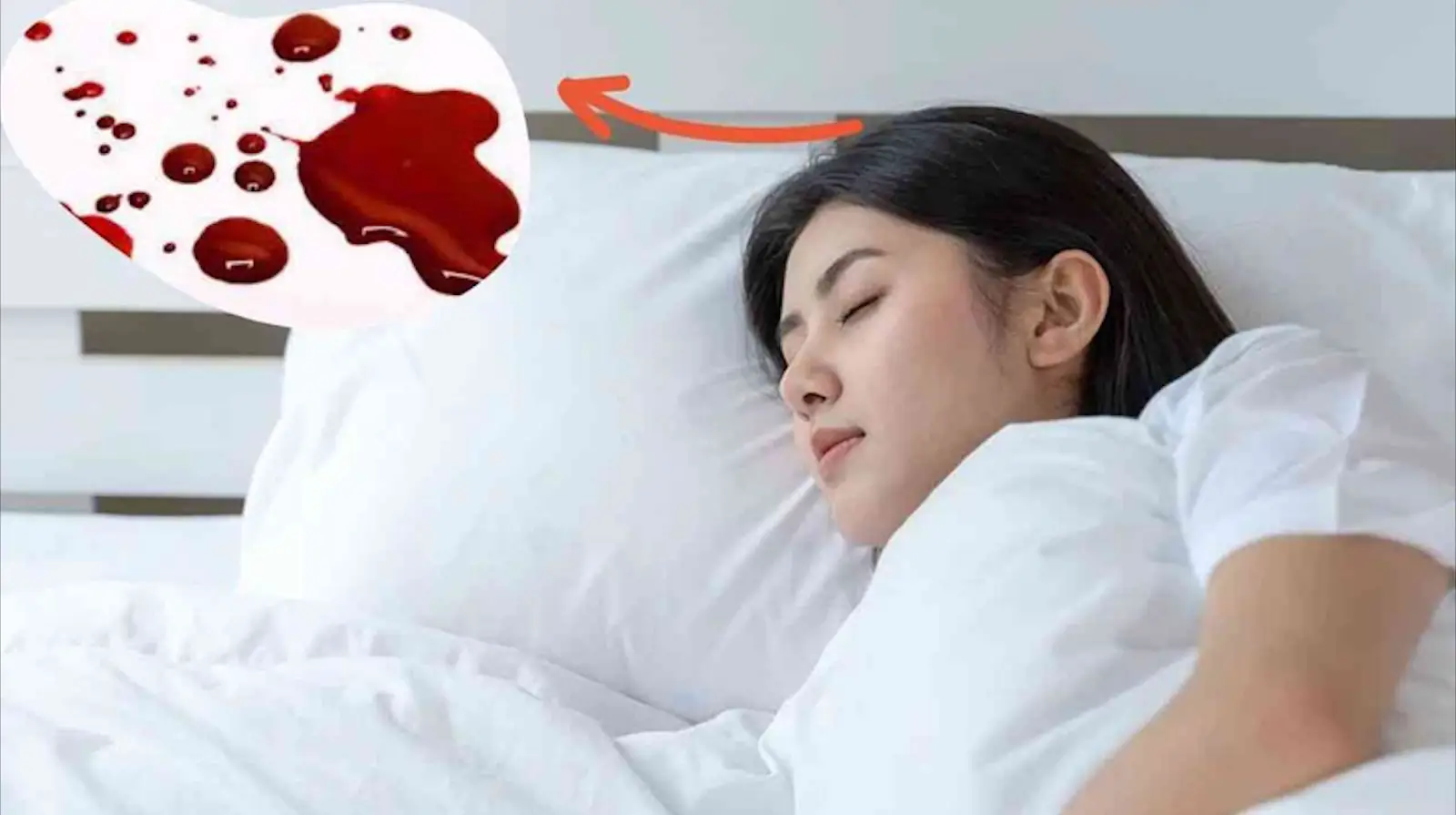 Mơ thấy máu kinh người khác