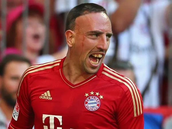 Franck Ribéry với biệt danh Gã mặt sẹo, một biệt danh của các cầu thủ nổi tiếng