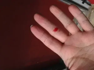 Bàn tay đứt chảy máu: Biểu tượng tâm linh.