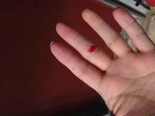 Bàn tay đứt chảy máu: Biểu tượng tâm linh.