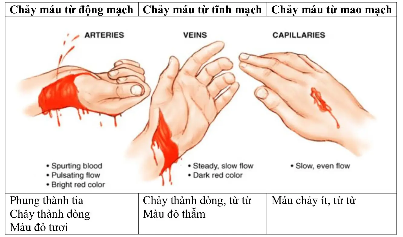Nằm Mơ Thấy Mình Chảy Máu: Giải Mã Điềm Báo & Hướng Hóa Giải 6 Vị trí chảy máu cơ thể: Nhận diện & phân loại.
