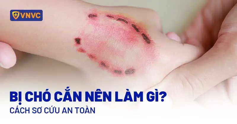 Bàn tay chó cắn: Ánh sáng chữa lành.
