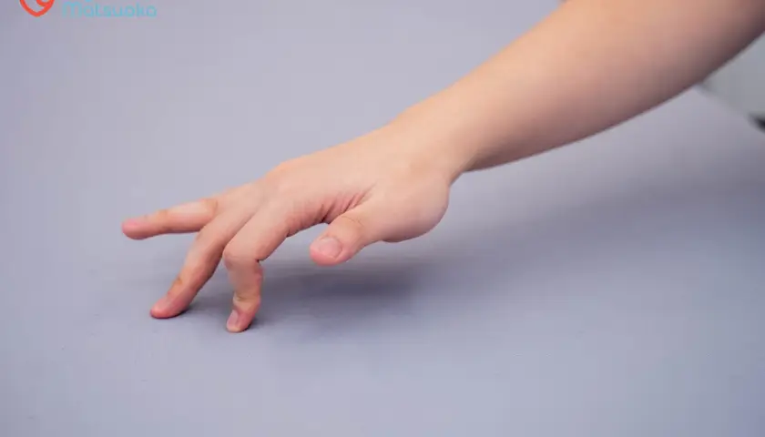 Nằm Mơ Thấy Mình Bị Cụt Tay: Giải Mã Điềm Báo Và Hóa Giải Hiệu Quả 5 Bàn tay hồi phục, nắm lấy cơ hội mới.