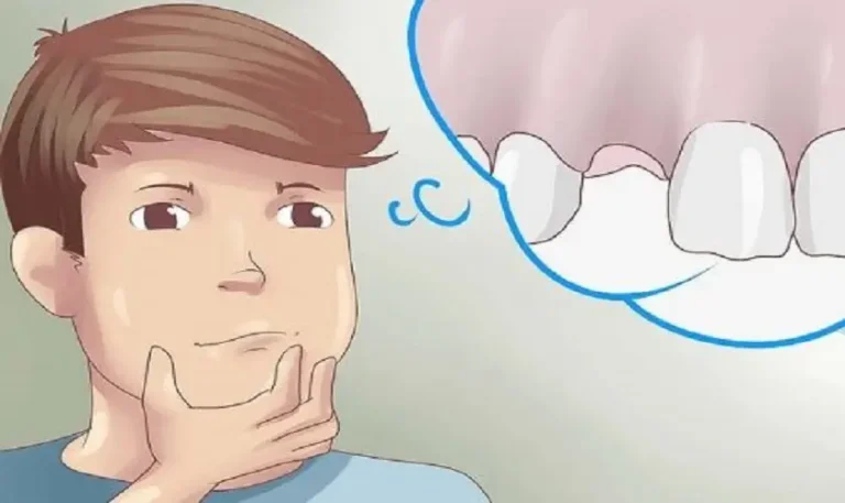 Băn khoăn giấc mơ răng rụng: Ý nghĩa gì?