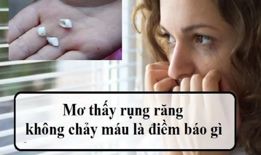 Nằm Mơ Thấy Rụng Răng Không Chảy Máu: Ý Nghĩa & Cách Hóa Giải 6 Giấc mơ rụng răng không chảy máu: Điềm lành, dữ.