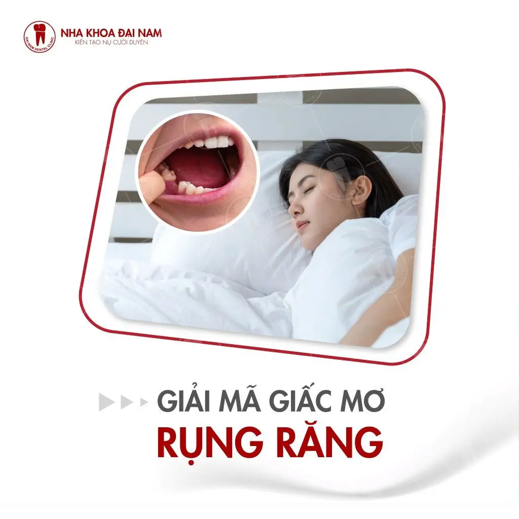 Nằm Mơ Thấy Bị Rụng Răng: Giải Mã Điềm Báo & Hóa Giải An Tâm 4 Răng Rụng Trong Mơ: Biểu Tượng Sâu Sắc