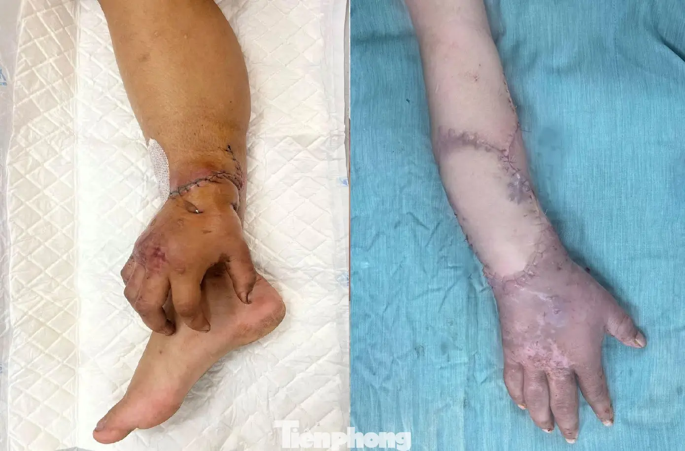 Giải Mã Giấc Mơ Thấy Mua Cá: Điềm Báo Tài Lộc Hay Cần Cảnh Giác? 6 Bàn tay từ bi phóng sinh cá