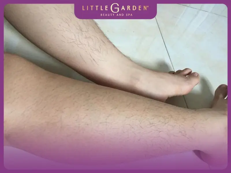 lông chân nhiều có ý nghĩa gì | Bí Mật Tướng Số