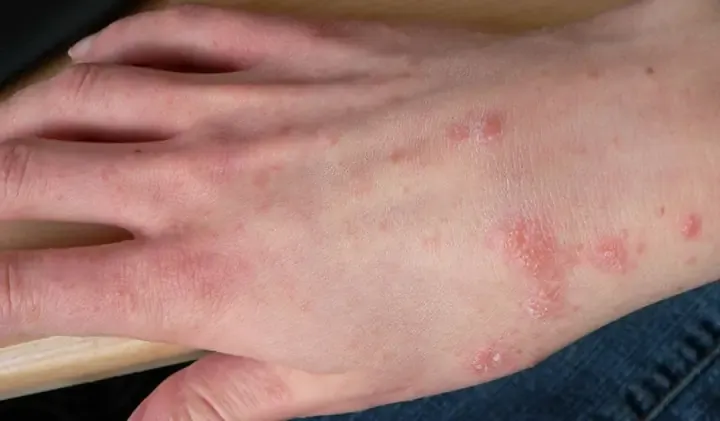 Giải Mã Giấc Mơ Thấy Ghẹ: Điềm Báo & Con Số May Mắn nằm mơ thấy ghẹ đánh đề con gì 2 Nằm Mơ Thấy Ghẹ Đánh Đề Con Gì?