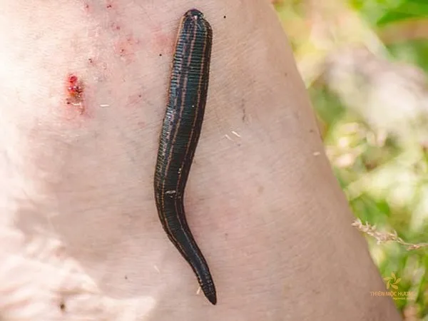 Mơ thấy đĩa đang hút máu