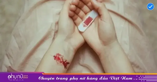 Nằm Mơ Thấy Đứt Tay Không Chảy Máu Đánh Con Gì? Giải Mã Bí Ẩn Và Con Số May Mắn