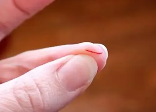 Nằm Mơ Thấy Đứt Tay Không Chảy Máu Đánh Con Gì? Giải Mã Bí Ẩn Và Con Số May Mắn