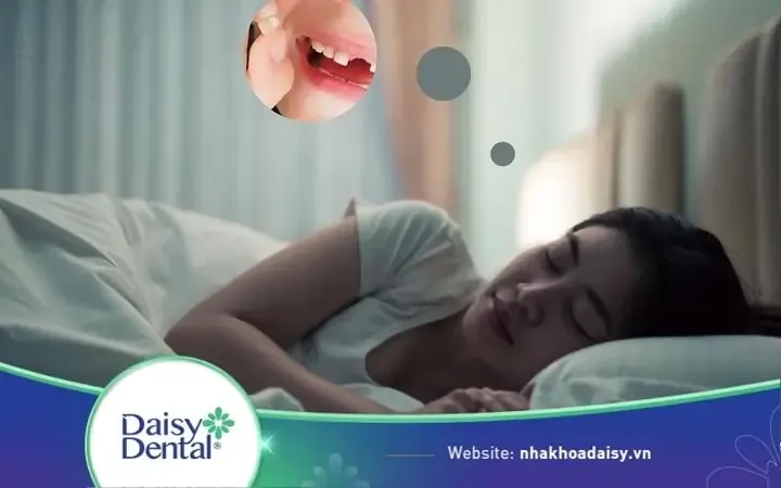 Sổ mơ lô đề chi tiết cho các trường hợp nằm mơ thấy rụng răng hàm trên giúp bạn tìm con số may mắn