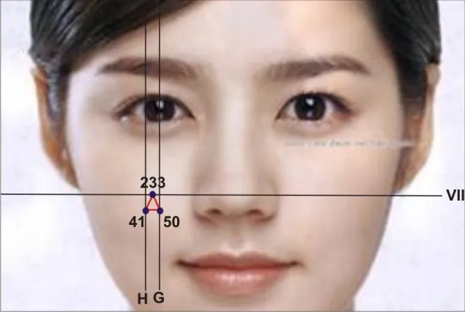 15-ky-thuat-dieu-tri-theo-dien-chan