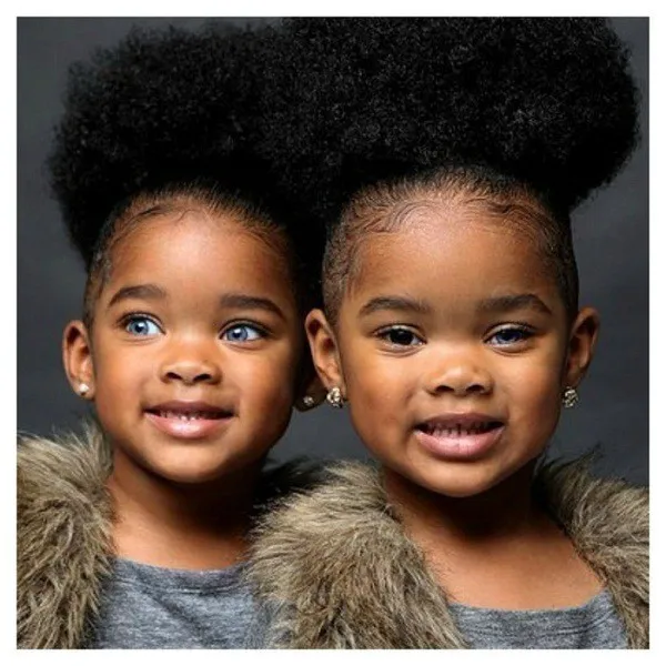 Sự khác biệt về màu mắt của hai anh em sinh đôi là hiện tượng khoa học thú vị