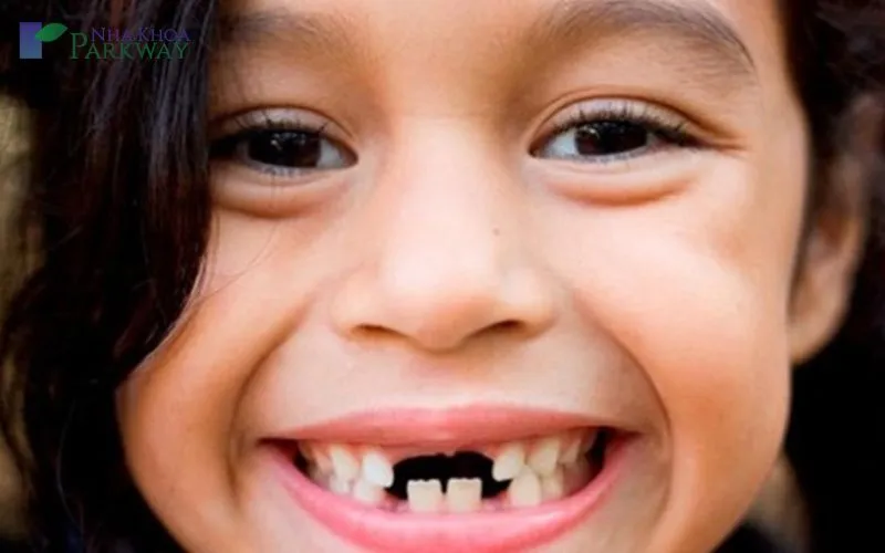 Giáº£i mÃ£ náº±m mÆ¡ bá»‹ sÃ¢u rÄƒng - 1