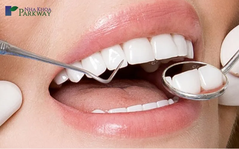 Giáº£i mÃ£ náº±m mÆ¡ bá»‹ sÃ¢u rÄƒng - 6