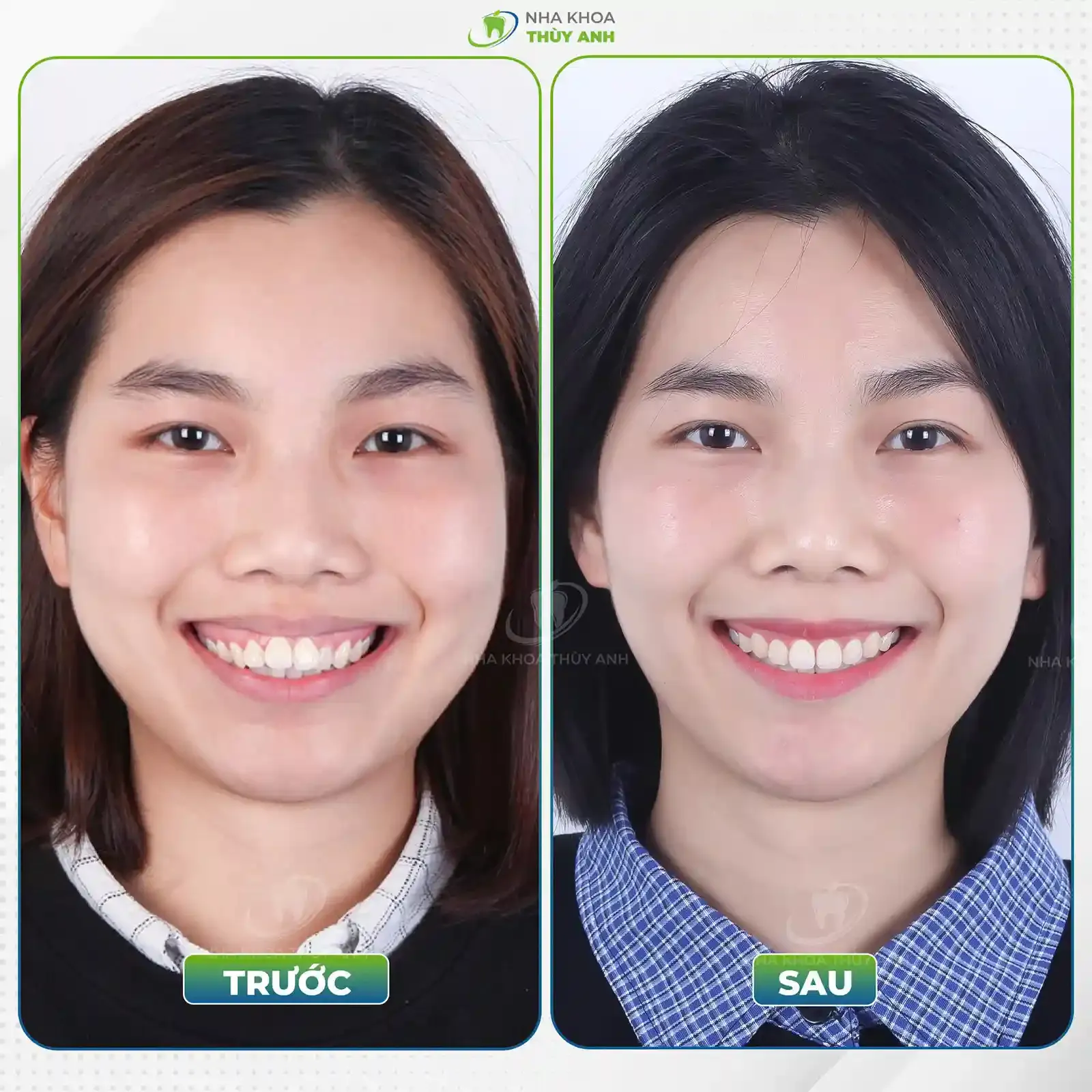 Tuổi hợp và xung khắc cho người 26 tuổi trong hôn nhân và hợp tác