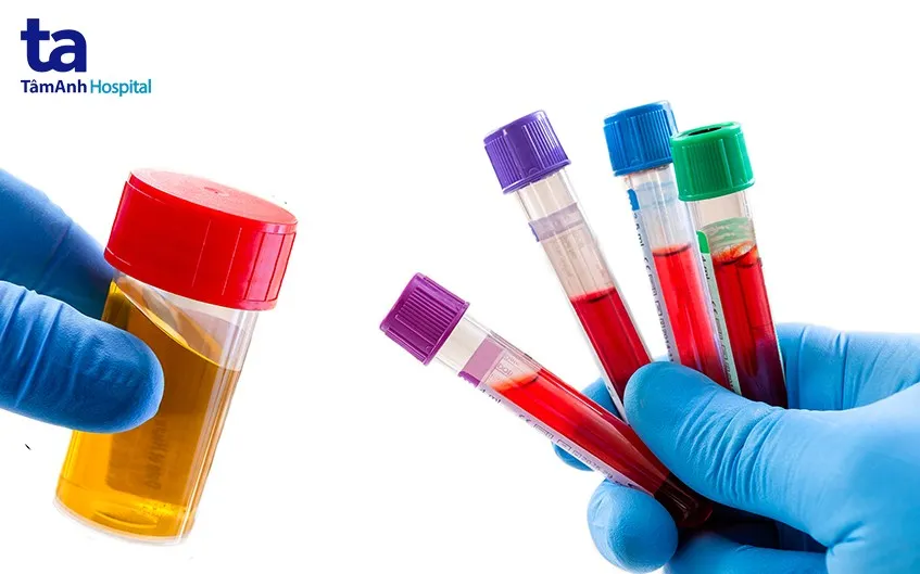 Các khối u hoặc sỏi thận có thể gây ra những cơn đau đột ngột và tình trạng xuất huyết đường niệu